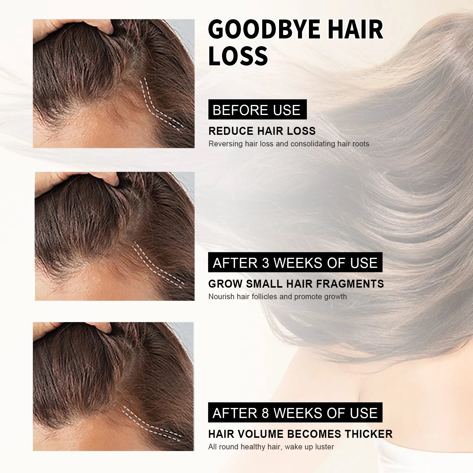 Hair Loss Treatment Shampoo Anti-itch Anti Dandruff Oil Control Hair Growth Serum Oil Scalp Root Thicker Fast Regrowth Essence