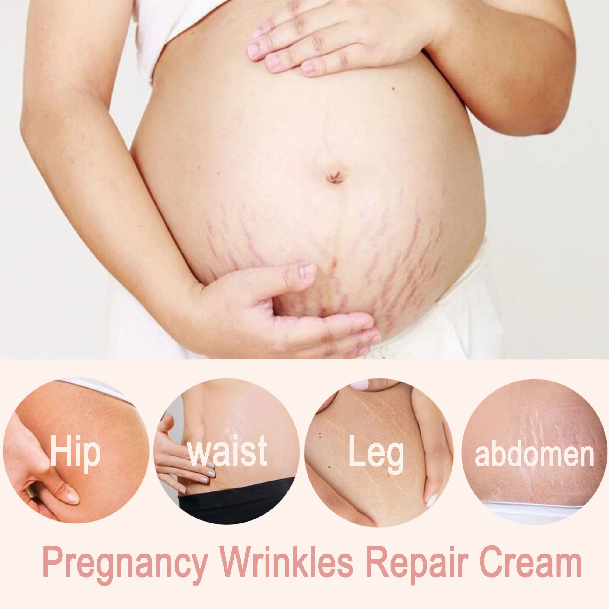 Remove stretch marks cream, promote cell regeneration, increase fiber elasticity, make skin smooth,skin smooth,bright,nutrition