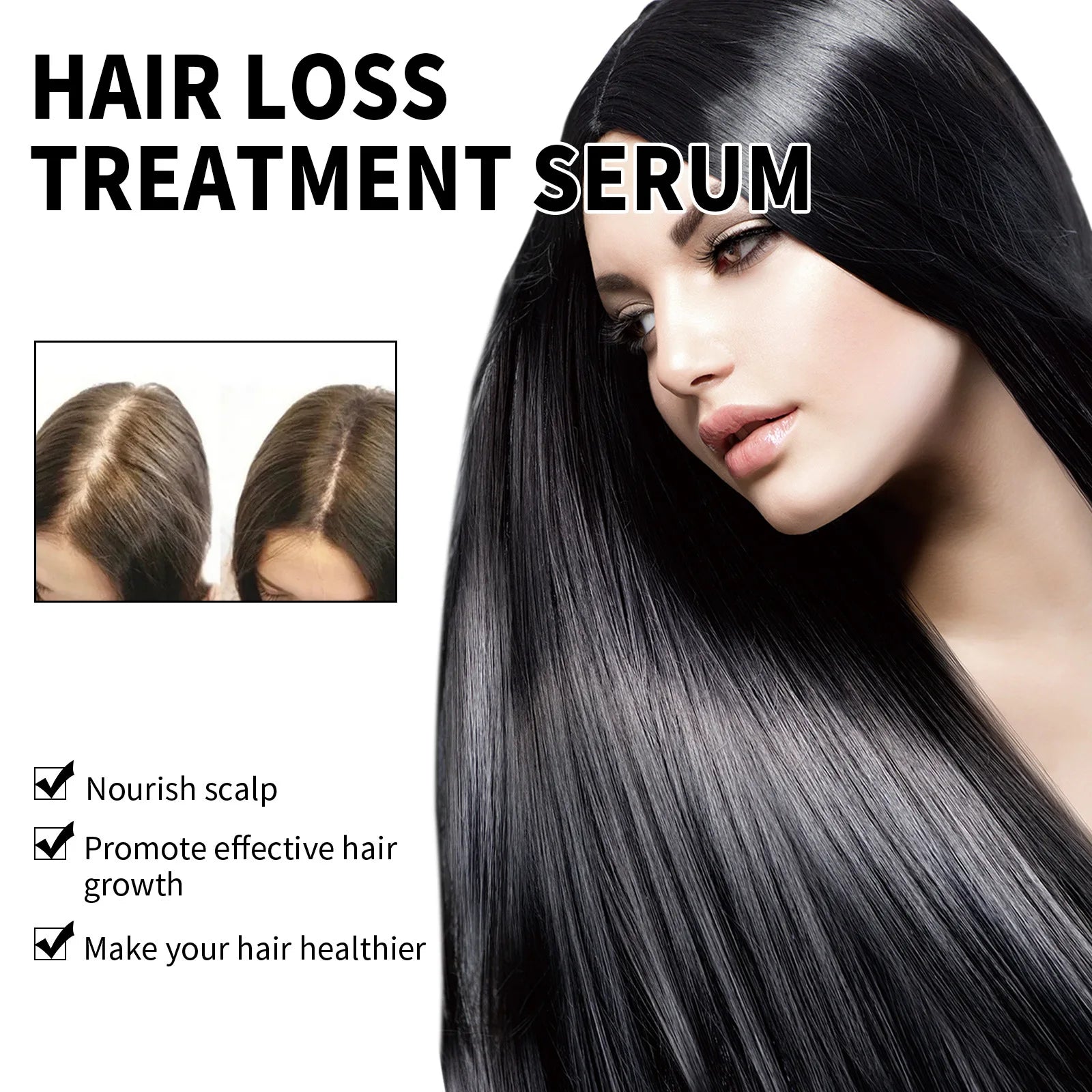 Hair Loss Treatment Shampoo Anti-itch Anti Dandruff Oil Control Hair Growth Serum Oil Scalp Root Thicker Fast Regrowth Essence