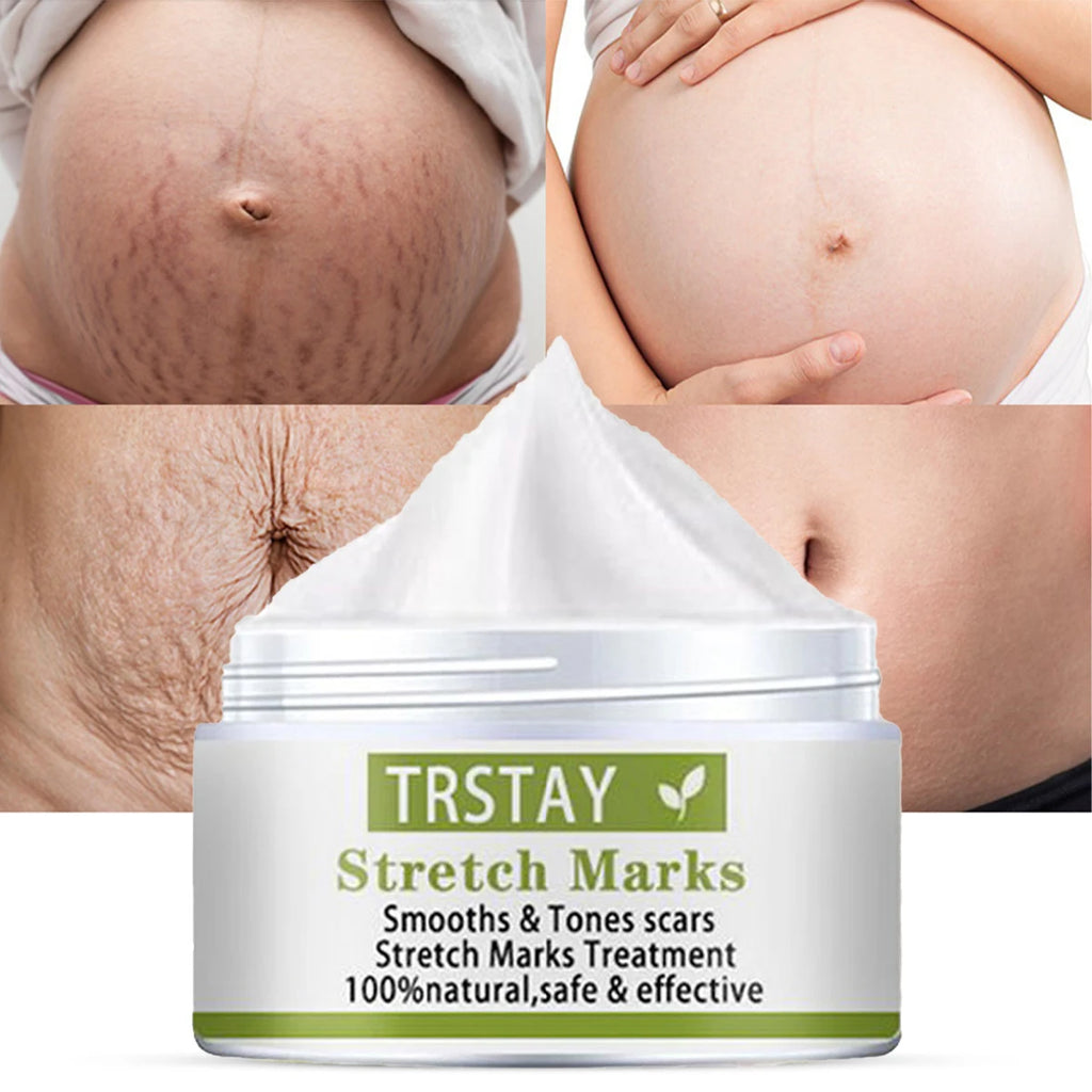 TRSTAY Stretch Mark Scar Repair Cream Enhances Skin Elasticity Moisture Collagen Improvement Safe And Effective