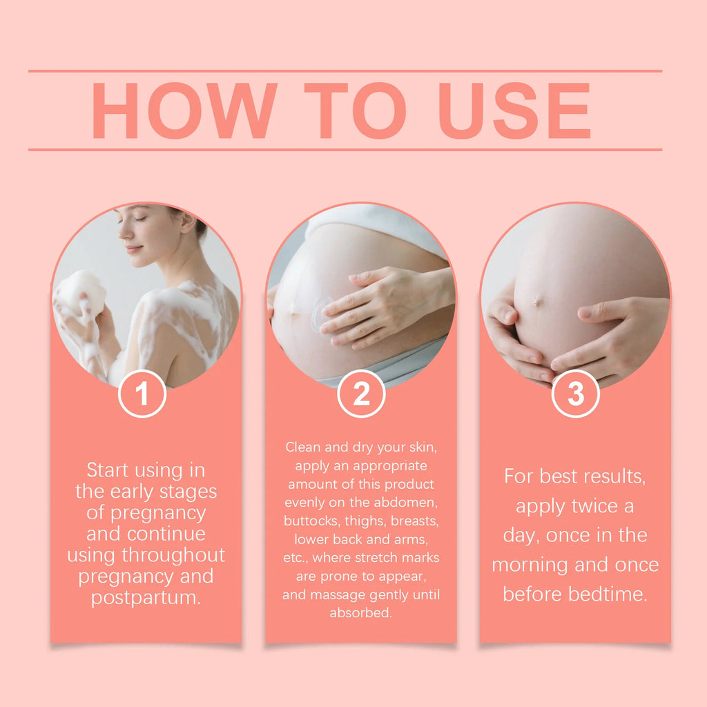 Stretch Mark Repair Cream Pregnant Women Anti Wrinkles Firming Nourishing Smoothing Improve Elasticity Remove Stretch Mark Cream