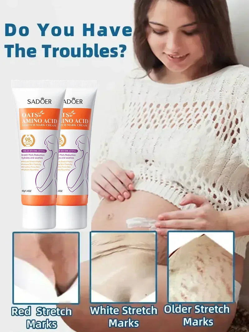 Pregnancy Repair Stretch Mark Removal Acne Scar Maternity Stretch Marks Remove Fat Striae Scars Treatment skin Care