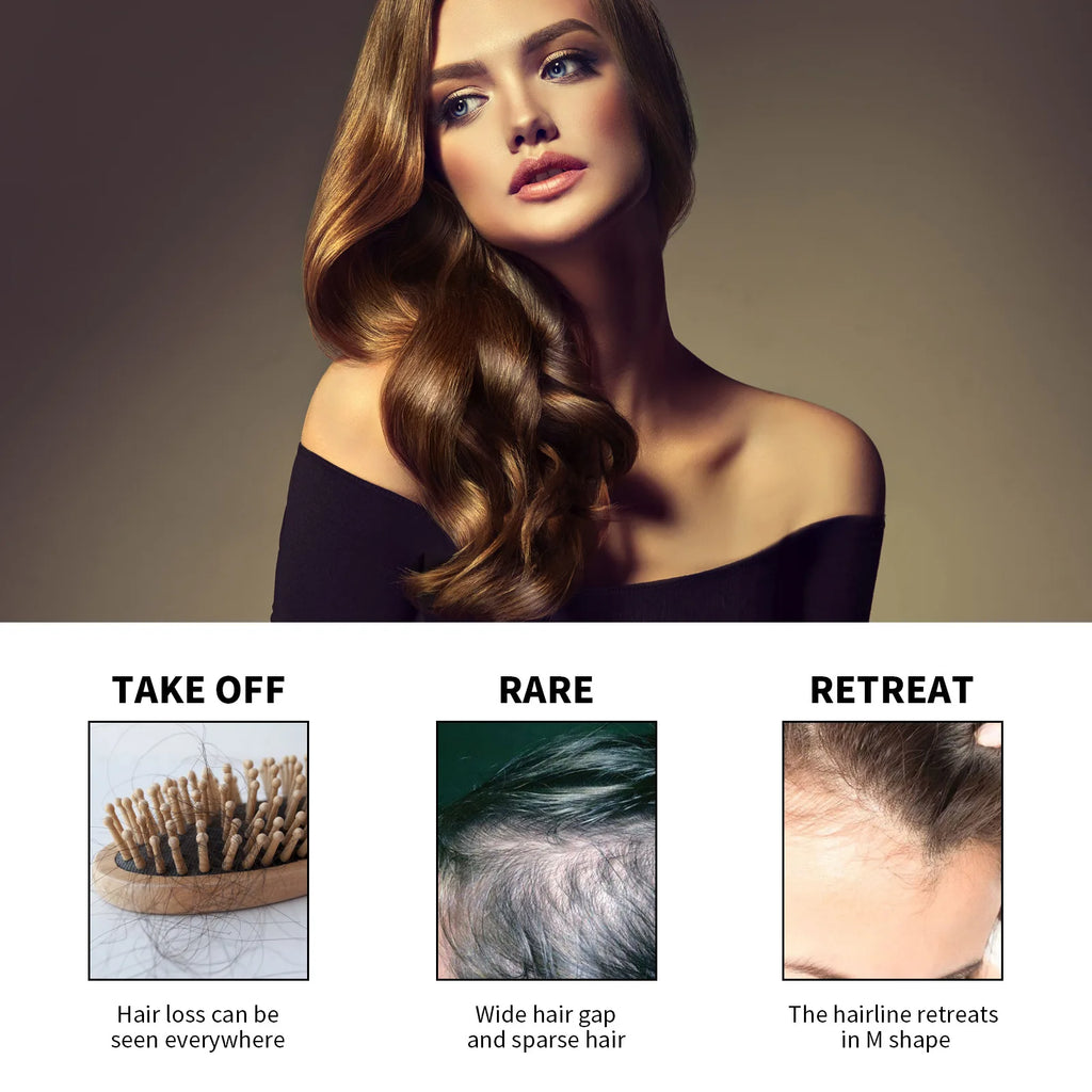 Hair Loss Treatment Shampoo Anti-itch Anti Dandruff Oil Control Hair Growth Serum Oil Scalp Root Thicker Fast Regrowth Essence