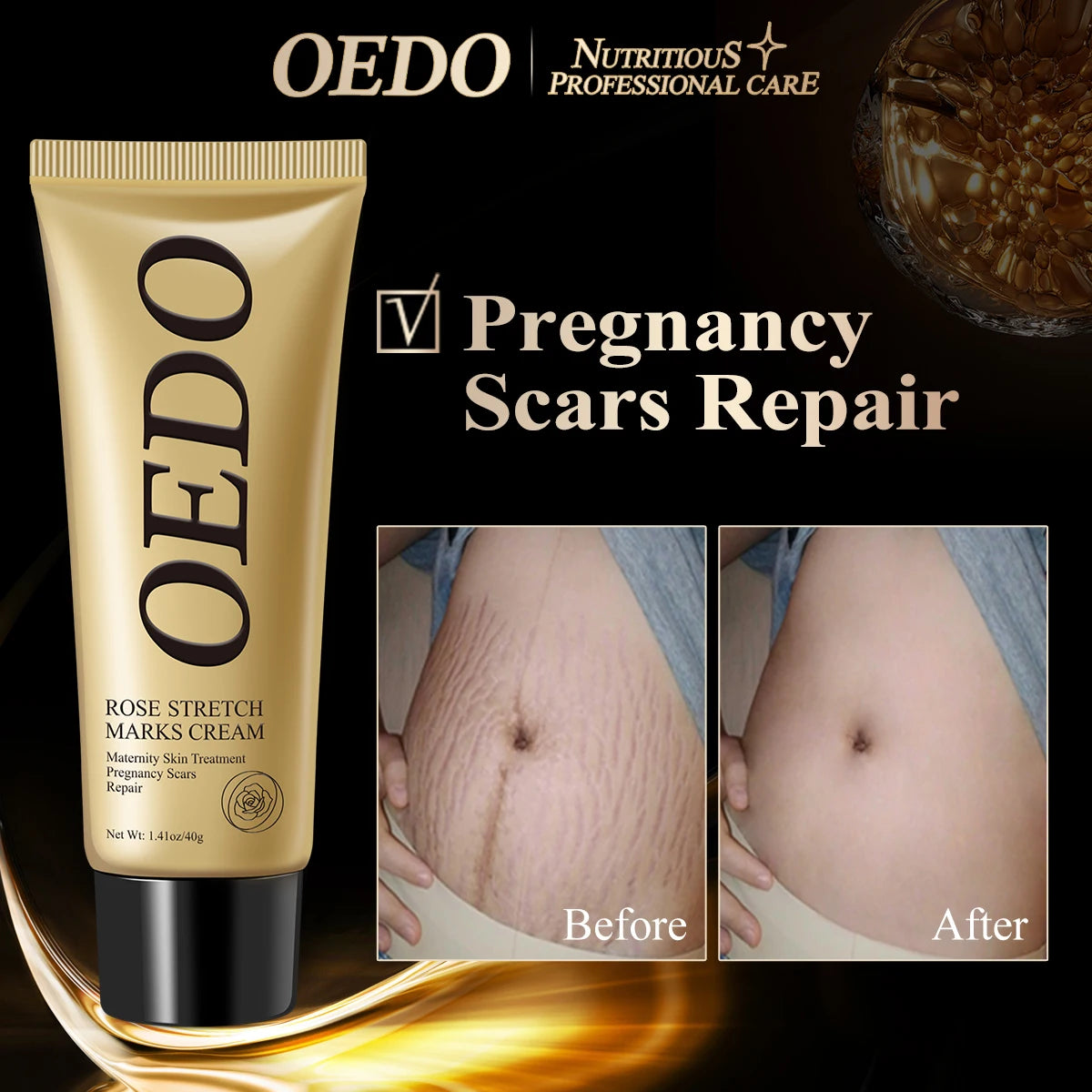 OEDO Stretch Mark Cream Remove Stretch Marks Skin Repair For Pregnant Women Remove Wrinkles Firm Skin Body Lotion Body Care
