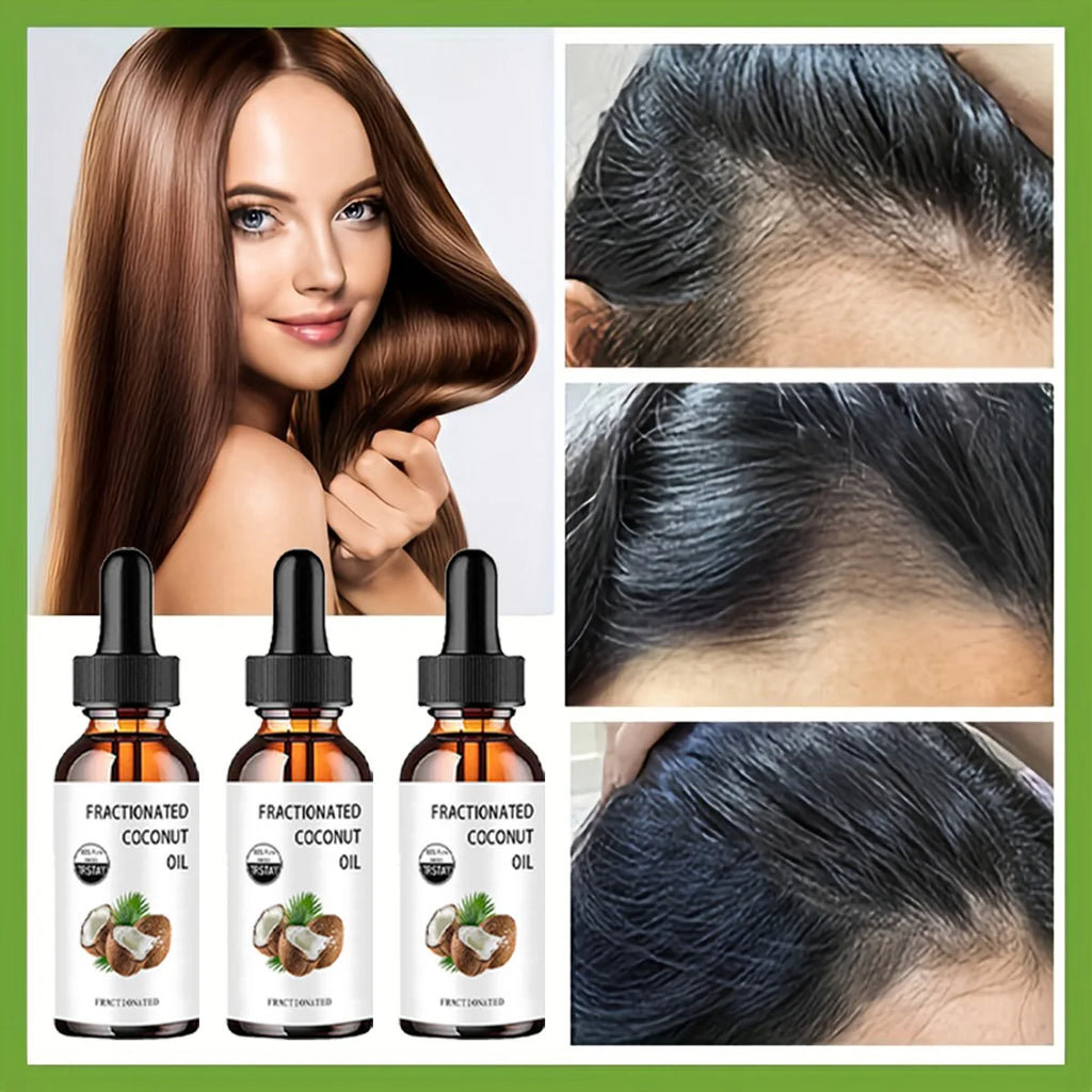 Fractionated Coconut Oil 100% pure coconut can moisturize, soften and care for dry and cracked skin, and can also be used as a h