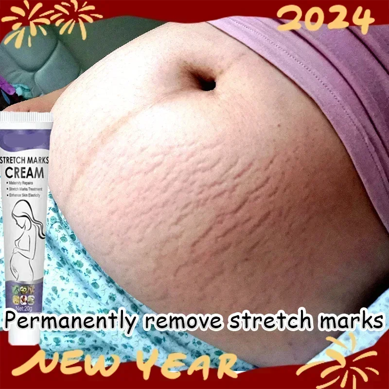 Stretch Marks Treatment Repair Essential Oil Skin Care Cream For Maternity Remover Anti-Wrinkle Slackline For Pregnant Body Oils