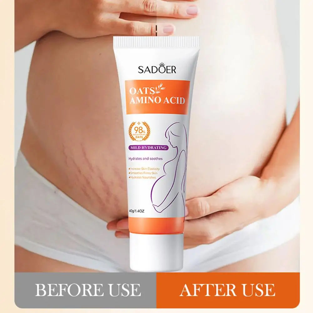 Removes Stretch Mark Cream To Remove Postpartum Obesity Pregnant Repair Anti-Aging Winkles Firming Body Cream Skin Care