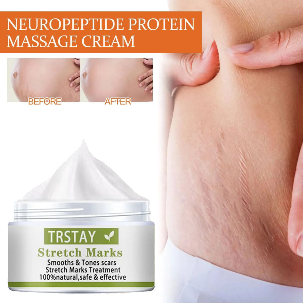 TRSTAY Stretch Mark Scar Repair Cream Enhances Skin Elasticity Moisture Collagen Improvement Safe And Effective