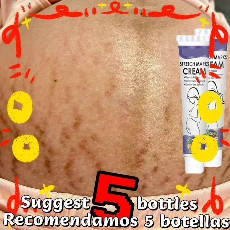 Stretch Marks Treatment Repair Essential Oil Skin Care Cream For Maternity Remover Anti-Wrinkle Slackline For Pregnant Body Oils