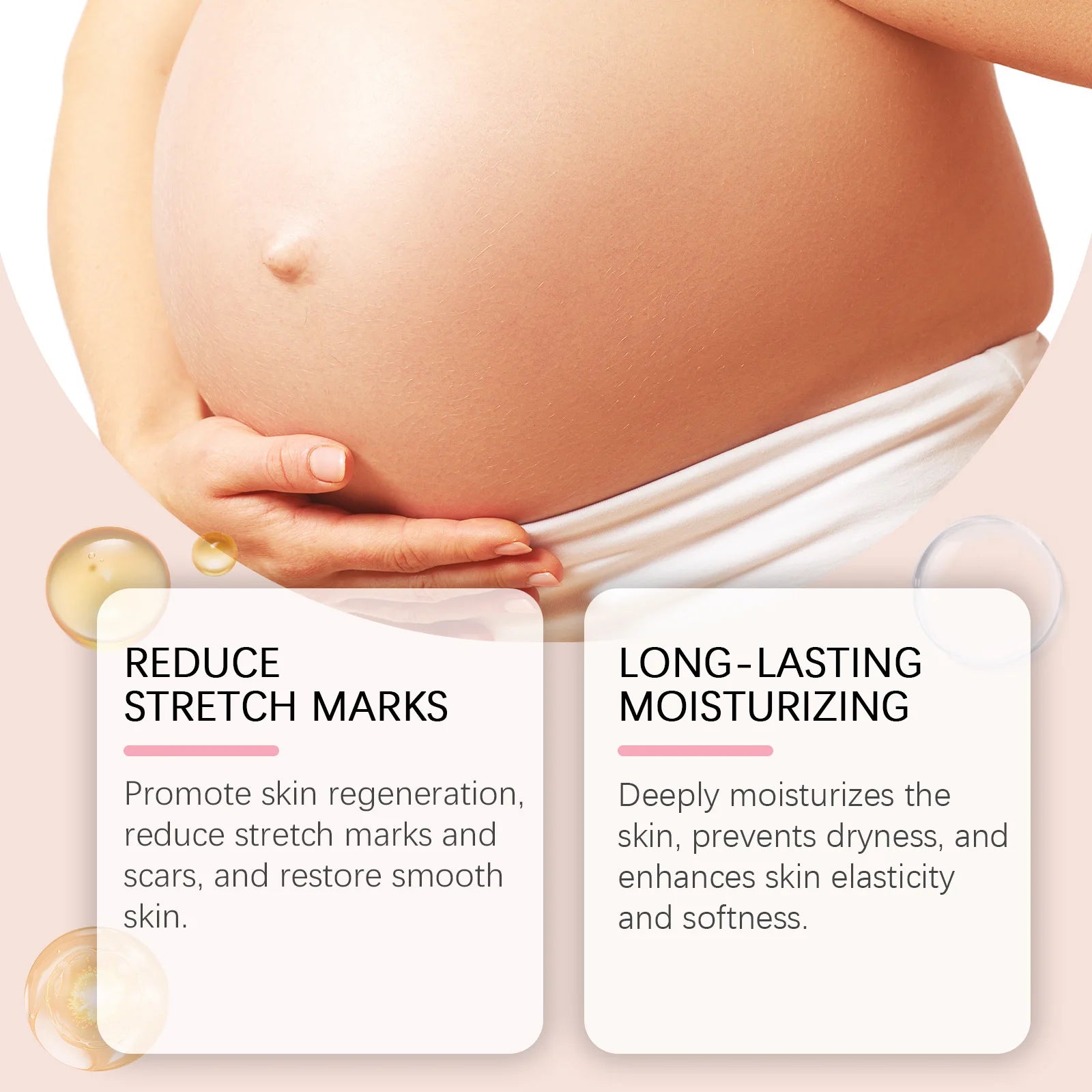 Stretch Mark Cream Postpartum Treatment Improves Firming Effective Removes Growth Lines Obesity Women Pregnant Mark Care Lotion
