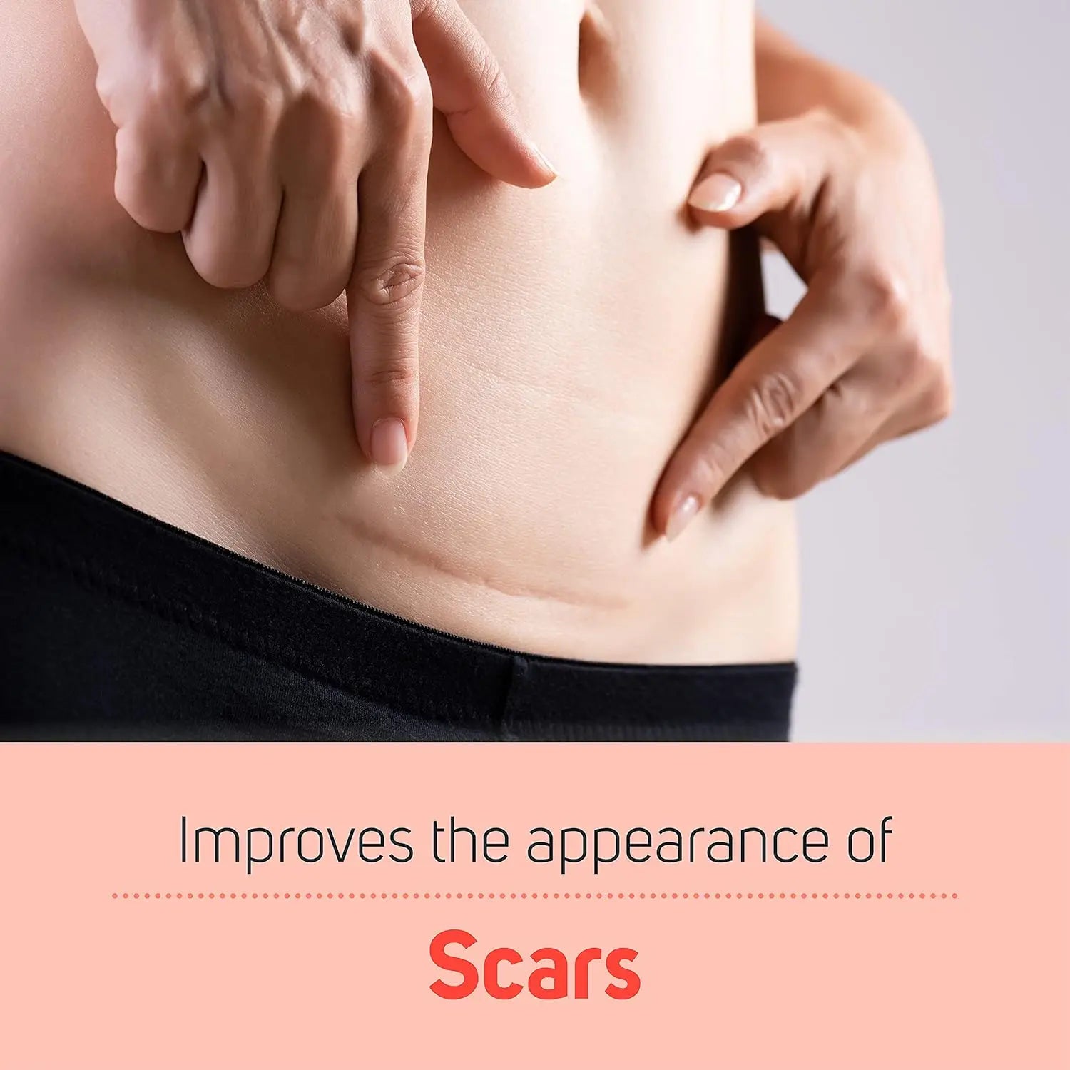 Stretch Marks Remover Essential Oil Pregnancy Maternity Body New Old Stretch Mark Removal Serum Increase Elasticity of Skin