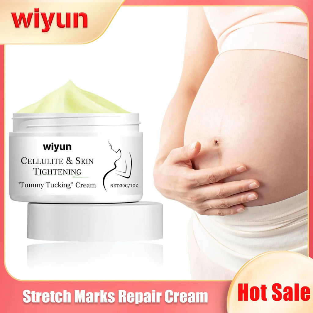 Remove Stretch Marks Cream Pregnant Women Repair Anti-Aging Anti-Winkles Sagging Increase Skin Elasticity Smoothing Firm Cream