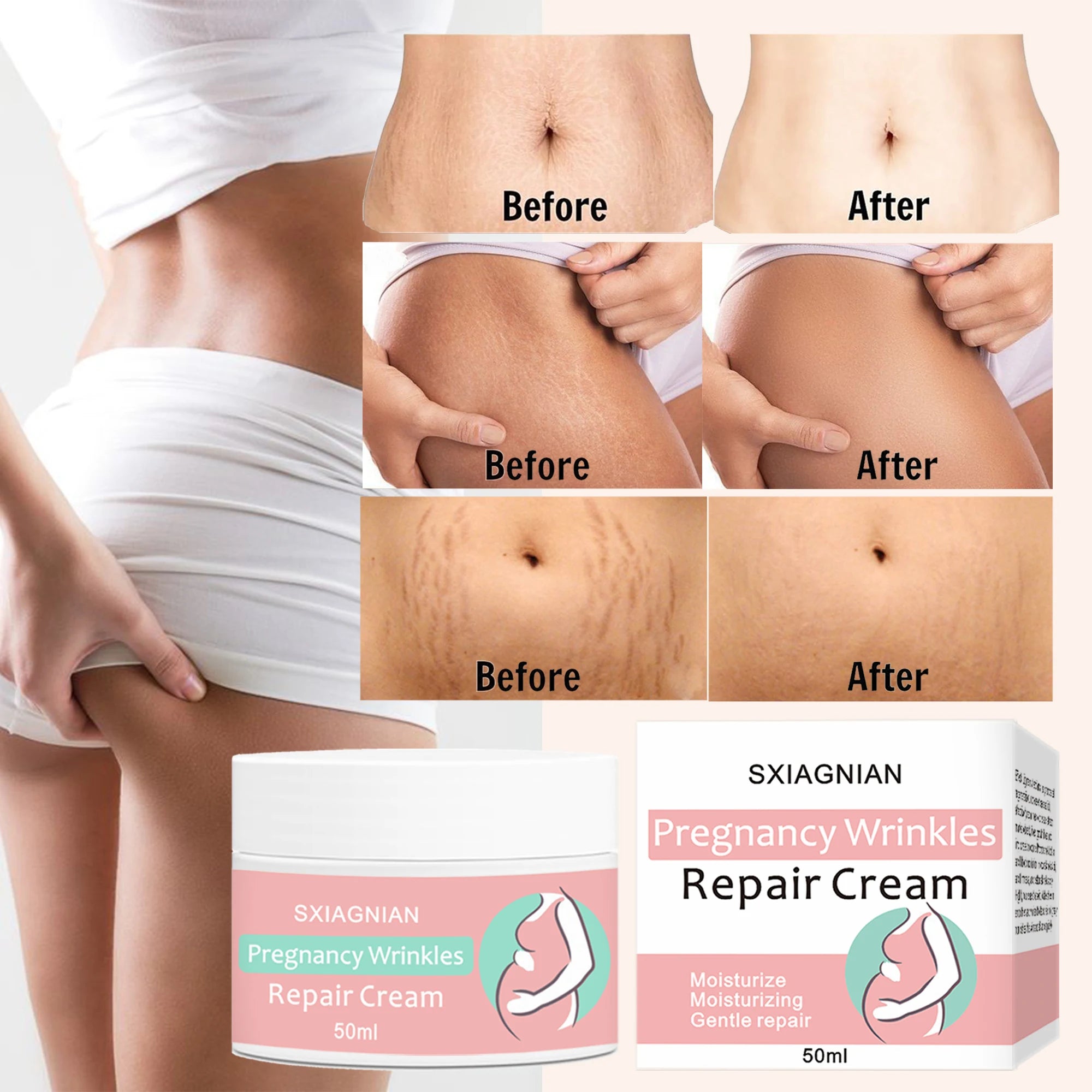 Remove stretch marks cream, promote cell regeneration, increase fiber elasticity, make skin smooth,skin smooth,bright,nutrition