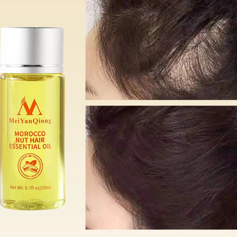 20ML Essential Oil for Hair Growth Prevent Hair Loss Promote Hair Growth Brighten and Smooth Oil Control  Rosemary Oil