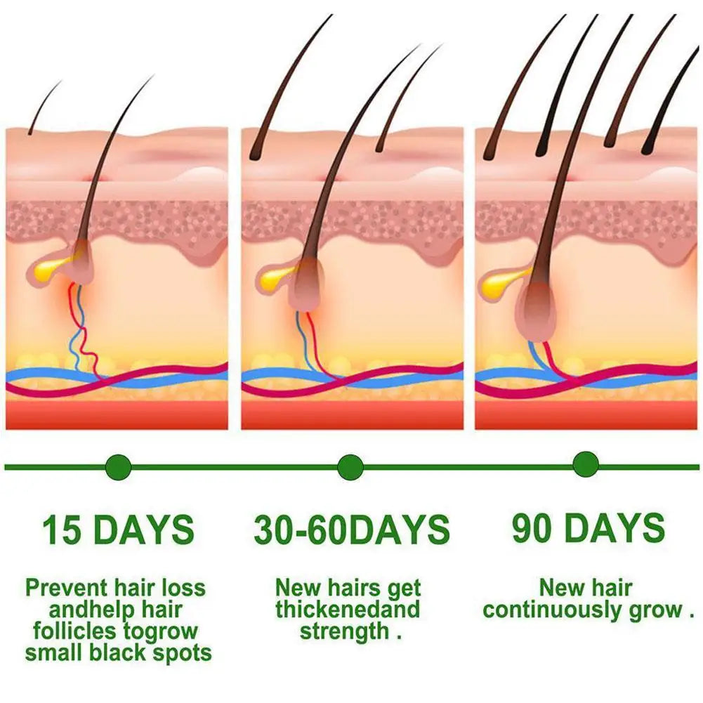 30ml Rosemary Essential Oil Hair Care Oils Pure Natural Hair Essential Oils For Nourish Shiny Hair Healthy Care