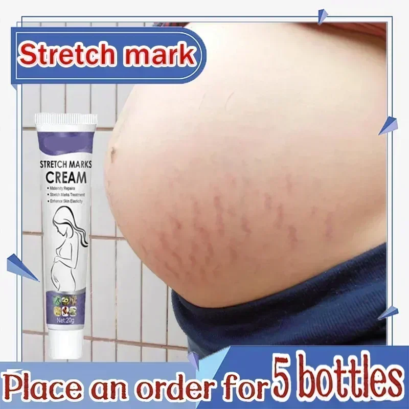 Stretch Marks Treatment Repair Essential Oil Skin Care Cream For Maternity Remover Anti-Wrinkle Slackline For Pregnant Body Oils