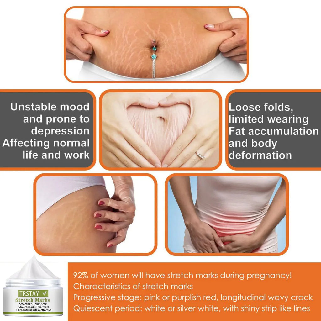 TRSTAY Stretch Mark Scar Repair Cream Enhances Skin Elasticity Moisture Collagen Improvement Safe And Effective