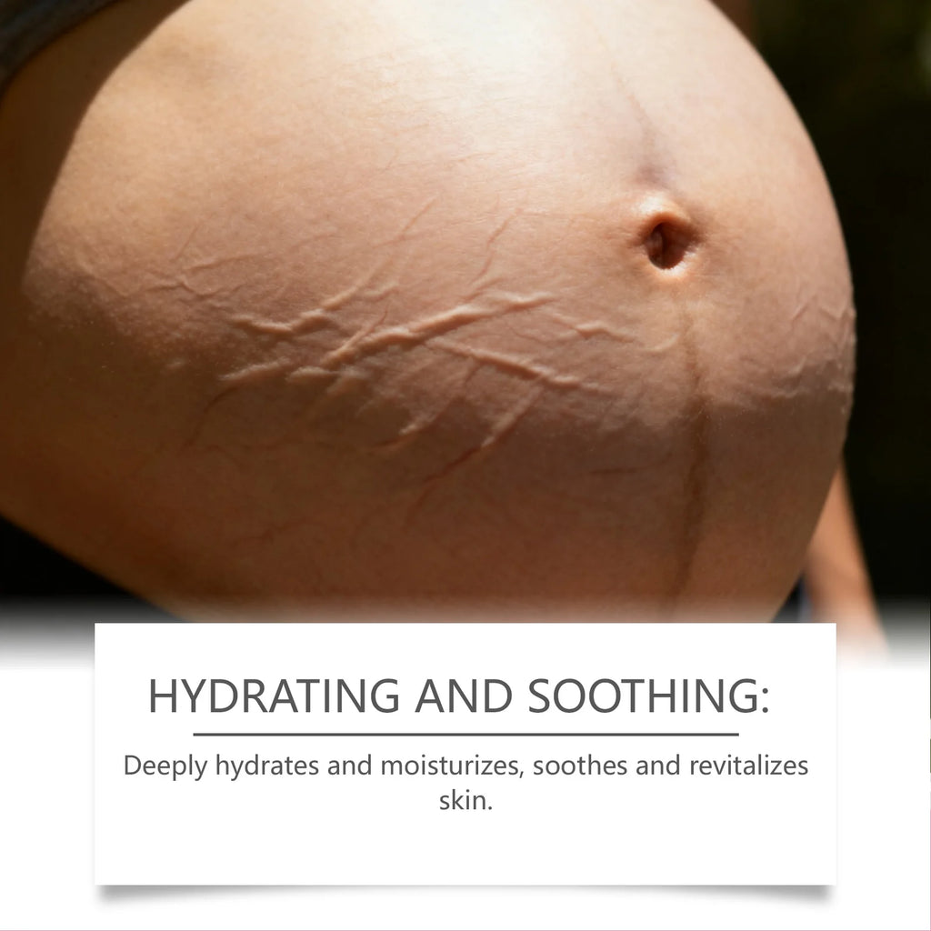 Pregnancy Stretch Mark Cream Smooth Skin Regeneration Deep Hydration Non-greasy Multifunctional Cream for Stretch Marks Removal
