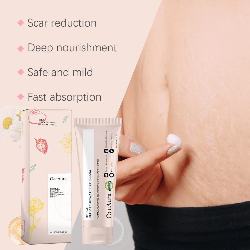 Stretch Mark Cream Postpartum Treatment Improves Firming Effective Removes Growth Lines Obesity Women Pregnant Mark Care Lotion