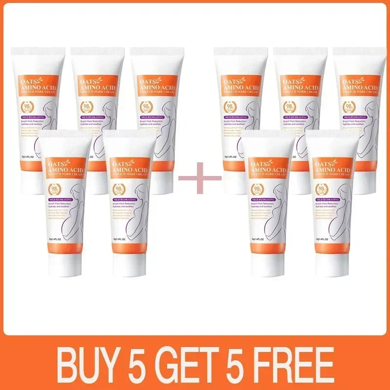 Cream For Pregnancy Stretch Marks Removal Eliminate Red White Old Stretch Marks  2025