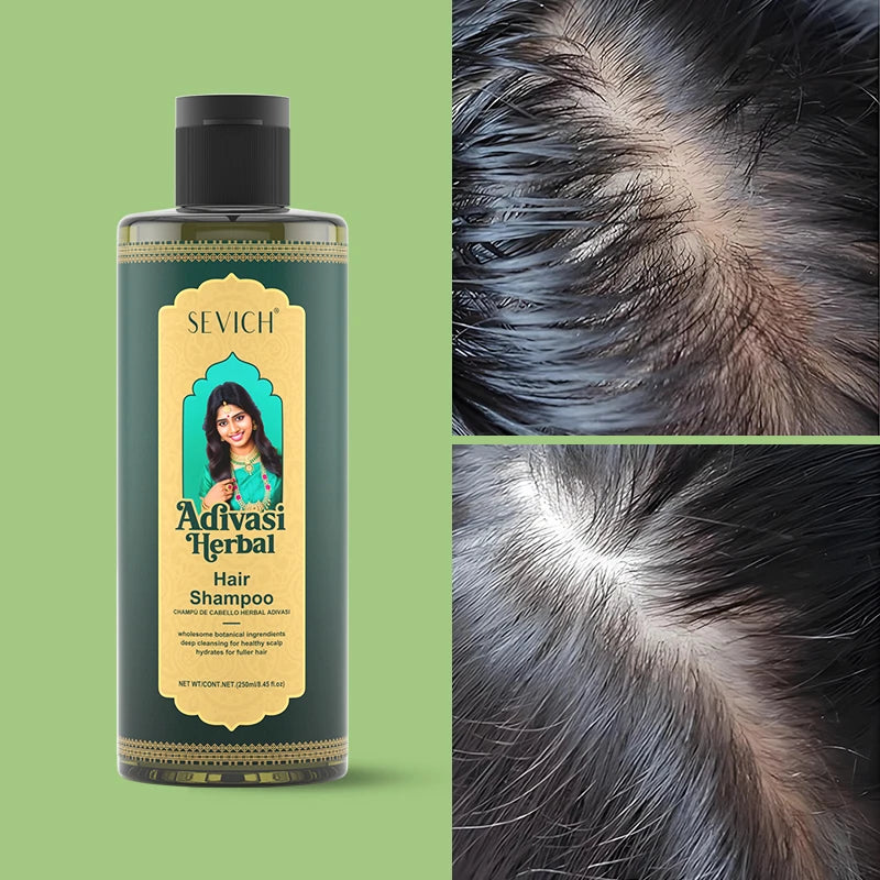 Herbal Hair Growth Set India Adivasi Rosemary Hair Regrowth Oil Ayurvedic Ginger Hair Care Shampoo Anti Hair Loss Treatment