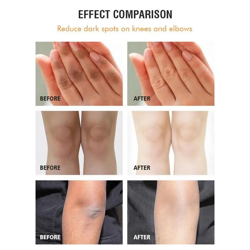 120g Whitening Cream Dark Neck Feet Underarm Elbows Melanin Remove Armpit Knees Bleach Black Spots Lighten Private Skin Care