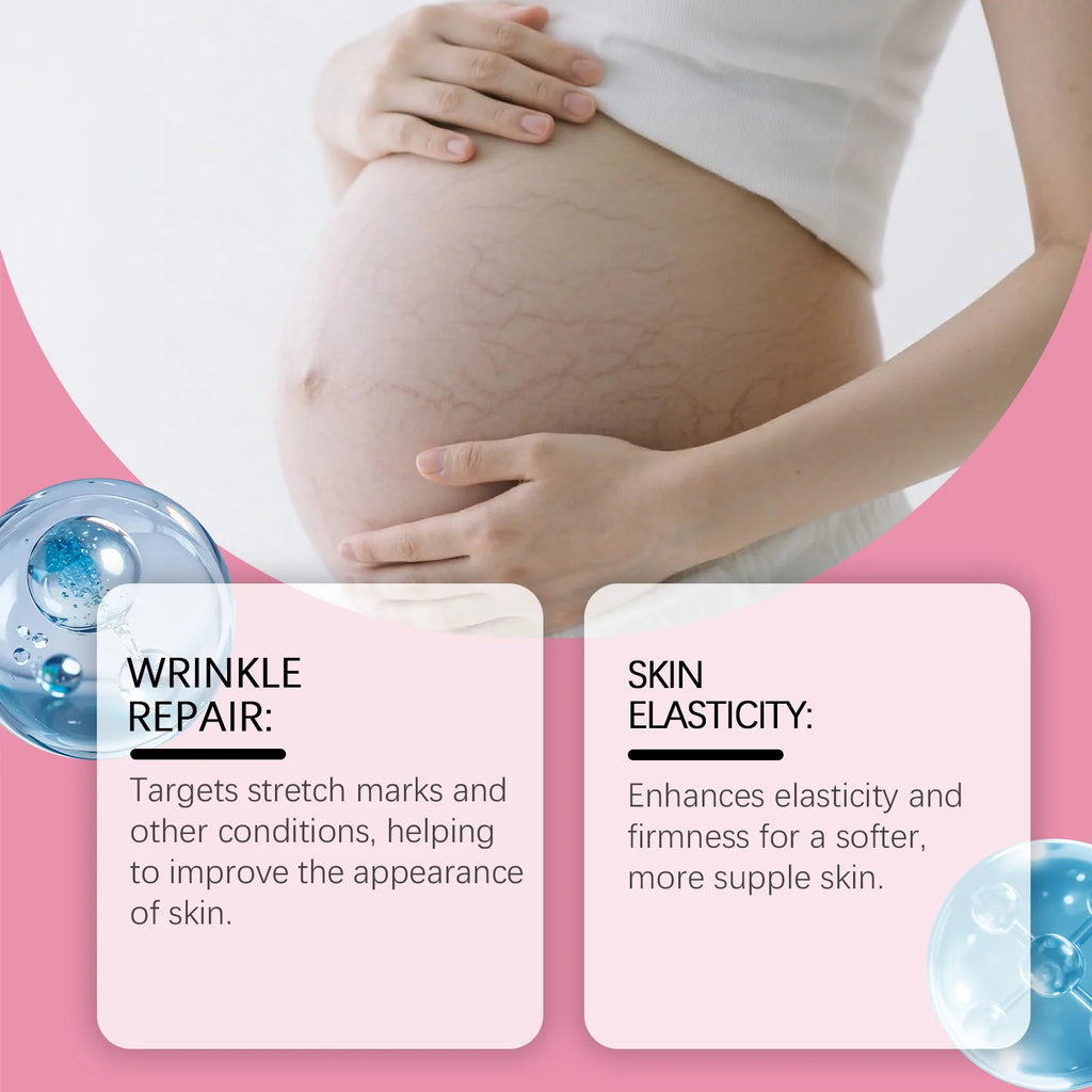 Pregnancy Stretch Mark Cream Smooth Skin Regeneration Deep Hydration Non-greasy Multifunctional Cream for Stretch Marks Removal