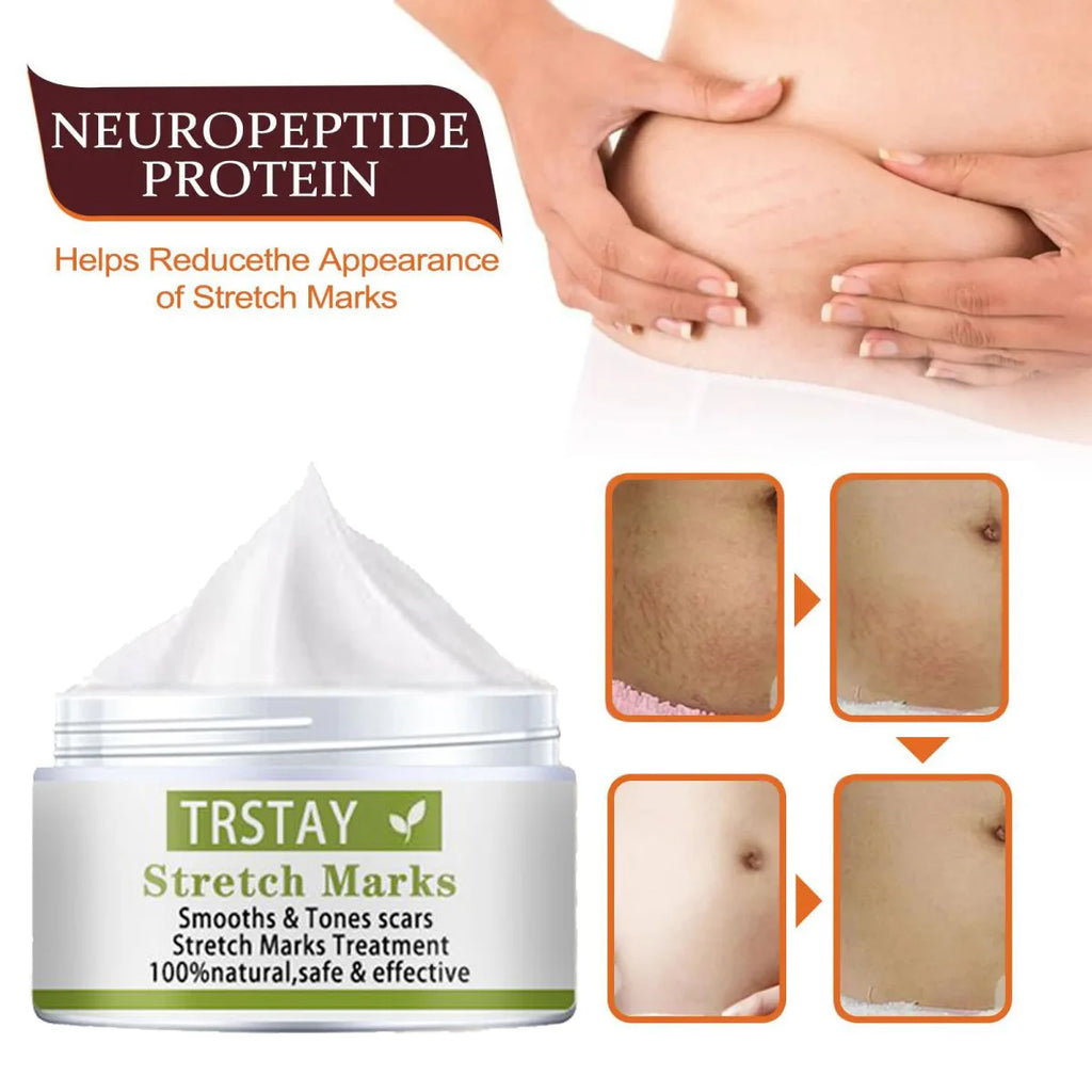 TRSTAY Stretch Mark Scar Repair Cream Enhances Skin Elasticity Moisture Collagen Improvement Safe And Effective