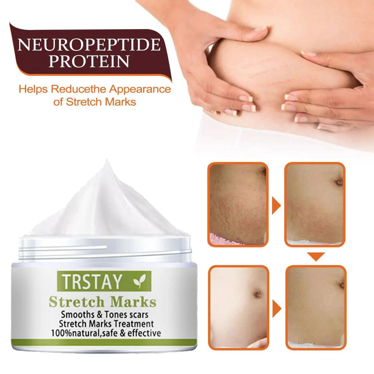TRSTAY Stretch Mark Scar Repair Cream Enhances Skin Elasticity Moisture Collagen Improvement Safe And Effective
